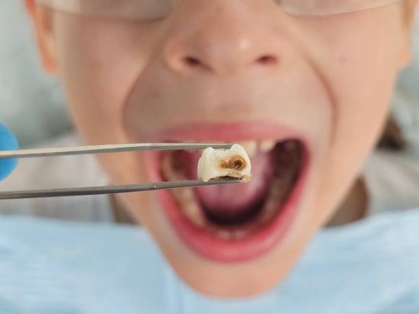 Best Dentist for Tooth Abscess  in Joliet, IL